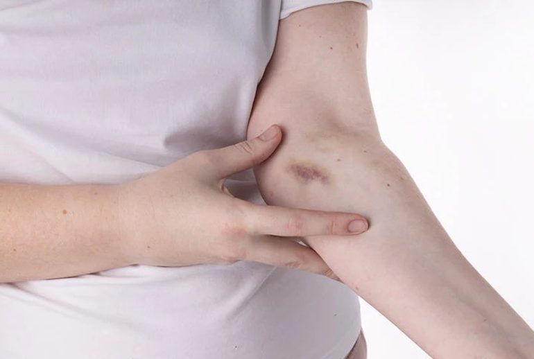 what-is-leukemia