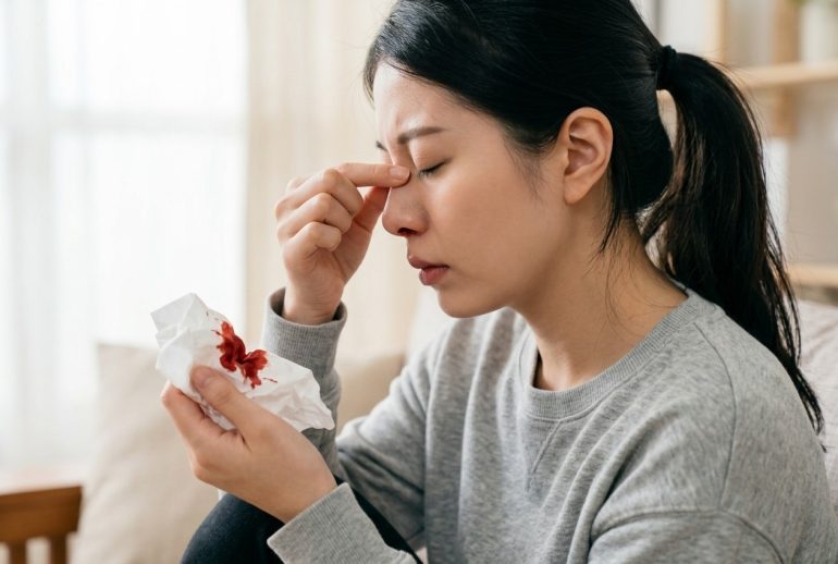 古方中醫堂_流鼻血要緊張嗎2